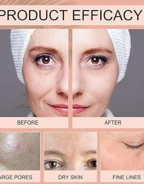 Before and after results showing effectiveness of Dropdash overnight collagen face mask on large pores dry skin and fine lines