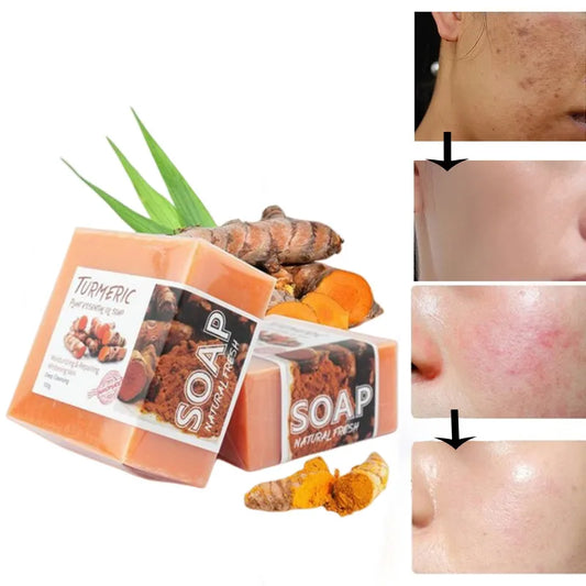 100g Turmeric Essential Oil Handmade Soap Face Wash Removal Acne Treatment Oil Control Moisturizing Whitening Soap Face Care