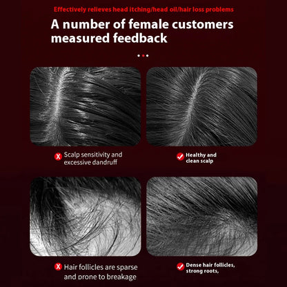 Electric Head Massager Hair Growth Comb Scalp Relax Massager 630nm Red Light Oil Applicator Anti-Hair Loss Hair Care Hairbrush
