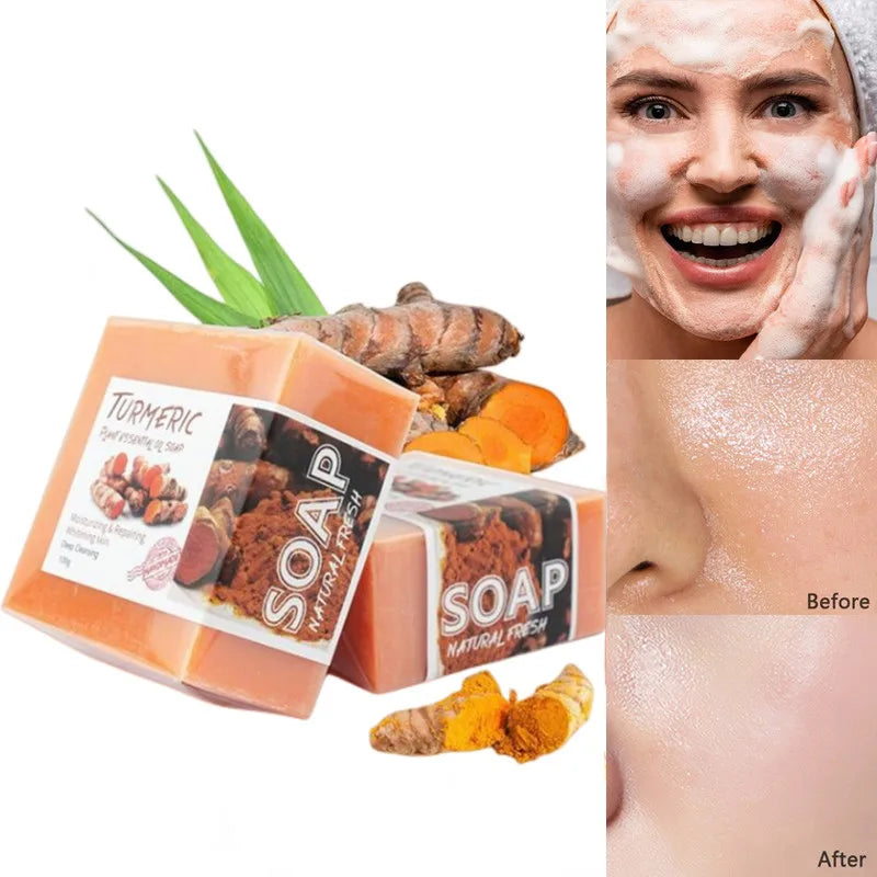100g Turmeric Essential Oil Handmade Soap Face Wash Removal Acne Treatment Oil Control Moisturizing Whitening Soap Face Care