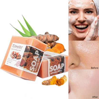 100g Turmeric Essential Oil Handmade Soap Face Wash Removal Acne Treatment Oil Control Moisturizing Whitening Soap Face Care