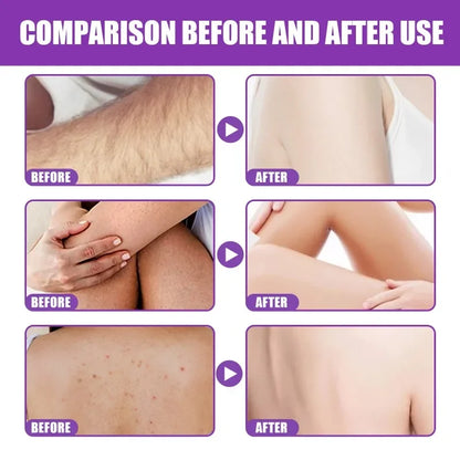 Body Scrub Cleaning Dead Skin Removal Melanin Facial Body Peeling Whitening Moisturizing Whitening Exfoliating Body Care Cream