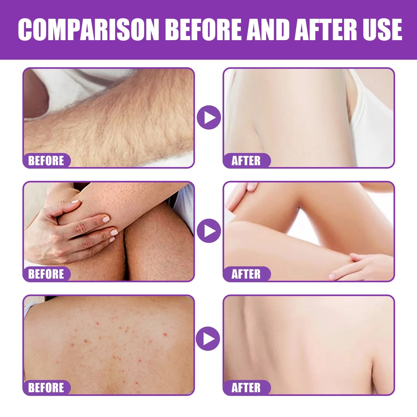 Body Scrub Cleaning Dead Skin Removal Melanin Facial Body Peeling Whitening Moisturizing Whitening Exfoliating Body Care Cream