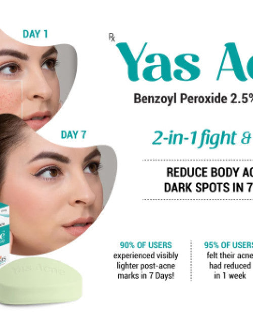 Dropdash 2.5% benzoyl peroxide face soap showing before and after acne treatment results in 7 days